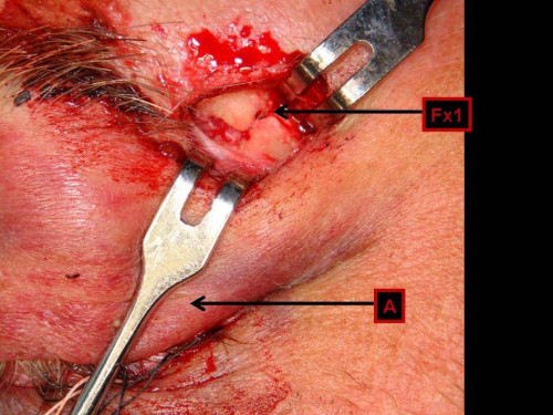 Makroskopie - Sutur intraoperativ nummeriert