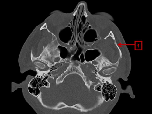 Bildgebung - CT axial nummeriert