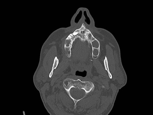 Bildgebung - CT