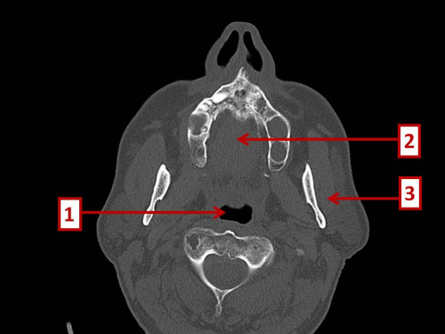 Bildgebung - CT