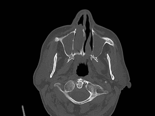 Bildgebung - CT