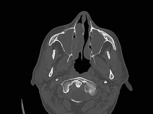 Bildgebung - CT