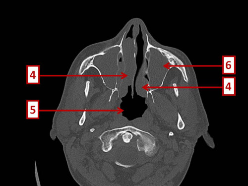 Bildgebung - CT