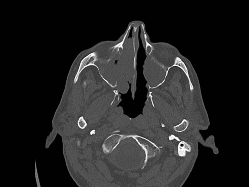 Bildgebung - CT