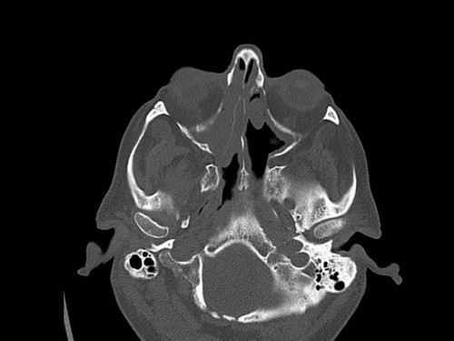 Bildgebung - CT