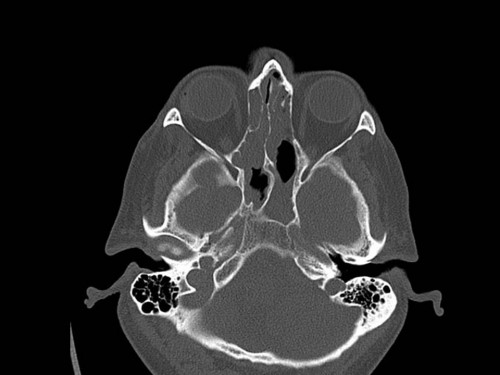 Bildgebung - CT