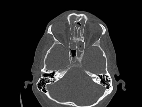Bildgebung - CT