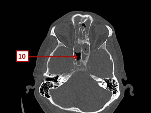 Bildgebung - CT