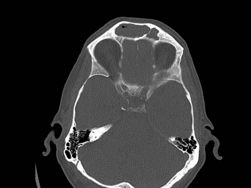 Bildgebung - CT