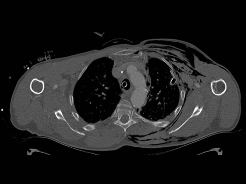 Bildgebung - CT