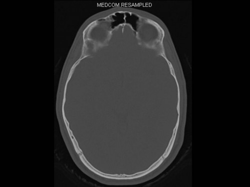 Bildgebung - CT axial