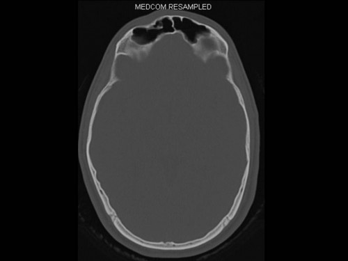 Bildgebung - CT axial