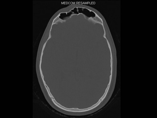 Bildgebung - CT axial