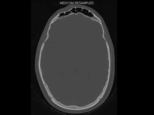 Bildgebung - CT axial