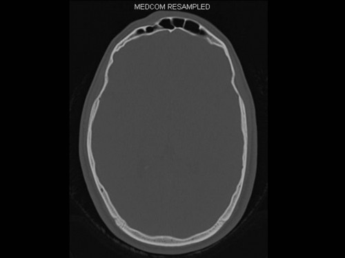 Bildgebung - CT axial