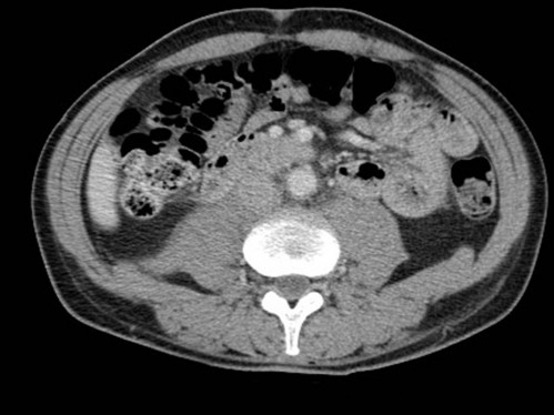 Bildgebung - CT axial