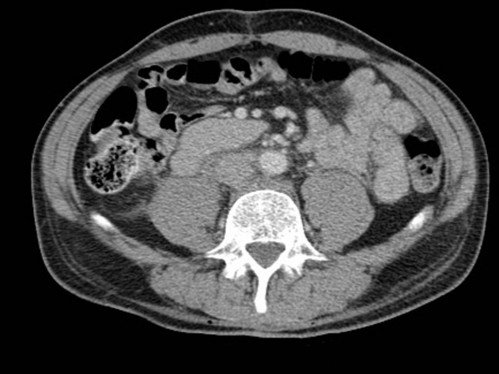 Bildgebung - CT axial
