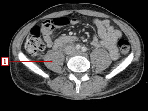 Bildgebung - CT axial nummeriert 1