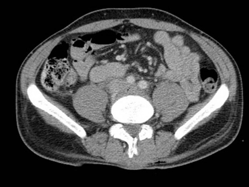 Bildgebung - CT axial