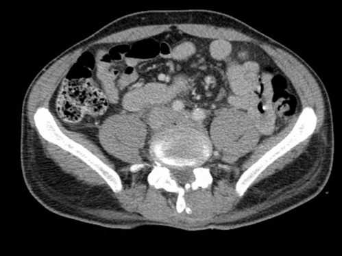 Bildgebung - CT axial