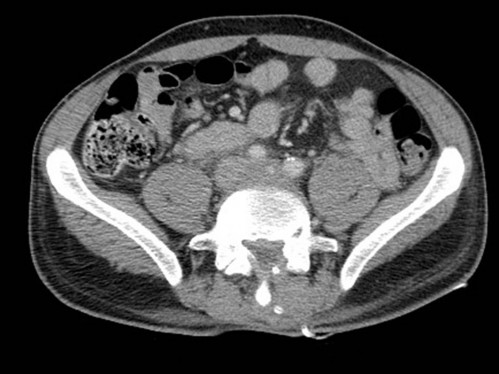 Bildgebung - CT axial