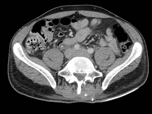 Bildgebung - CT axial