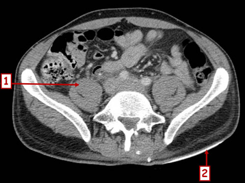 Bildgebung - CT axial nummeriert 2