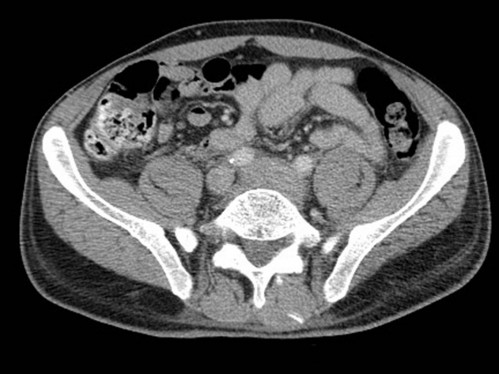 Bildgebung - CT axial
