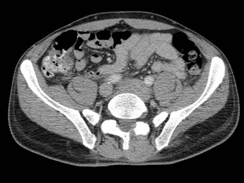 Bildgebung - CT axial
