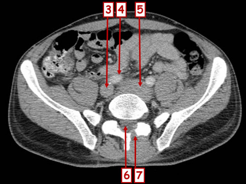 Bildgebung - CT axial nummeriert 3
