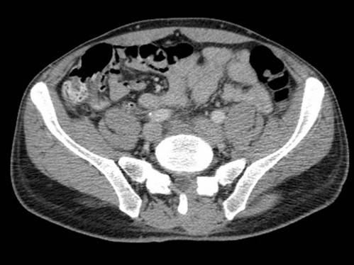 Bildgebung - CT axial