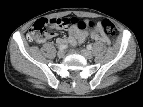 Bildgebung - CT axial
