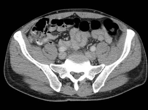Bildgebung - CT axial