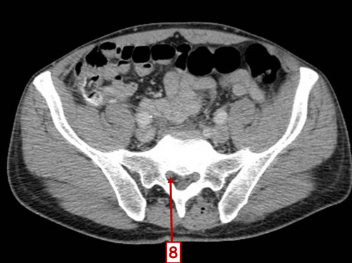 Bildgebung - CT axial nummeriert 4