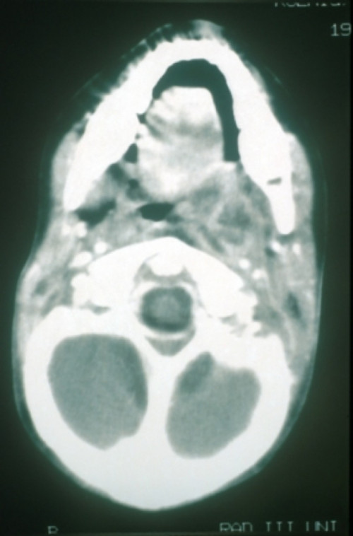 Bildgebung - CT (axial)