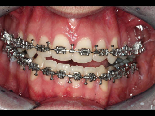 Makroskopie - intraoral