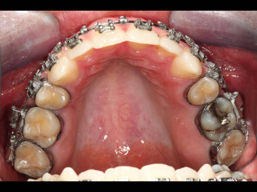 Makroskopie - intraoral