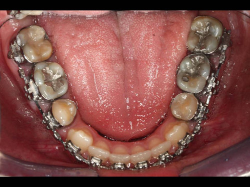 Makroskopie - intraoral