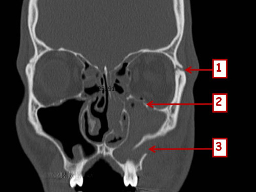 Bildgebung - CT - präoperativ