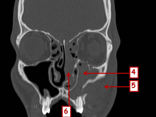 Bildgebung - CT - präoperativ