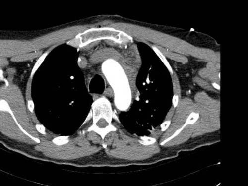 Bildgebung - CT