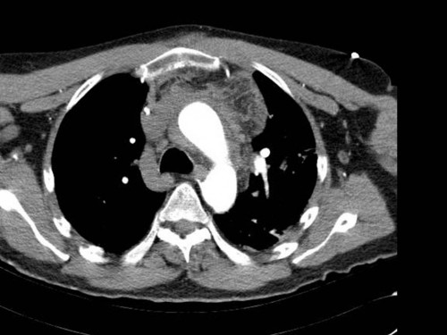 Bildgebung - CT