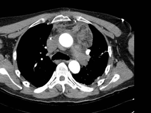 Bildgebung - CT
