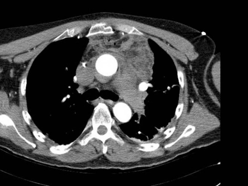 Bildgebung - CT