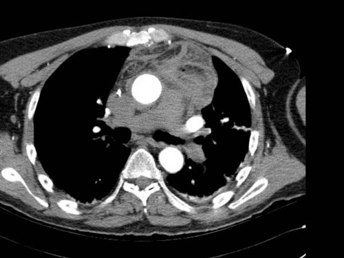 Bildgebung - CT