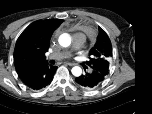 Bildgebung - CT