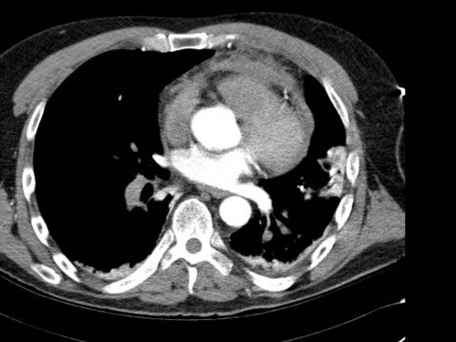 Bildgebung - CT