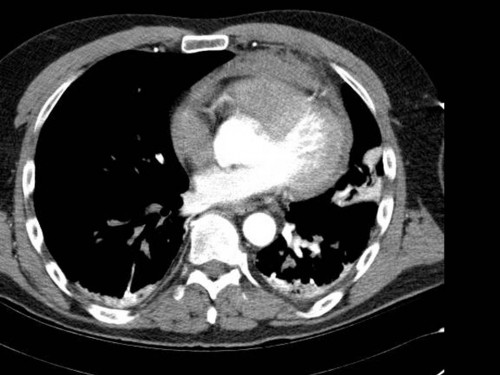 Bildgebung - CT
