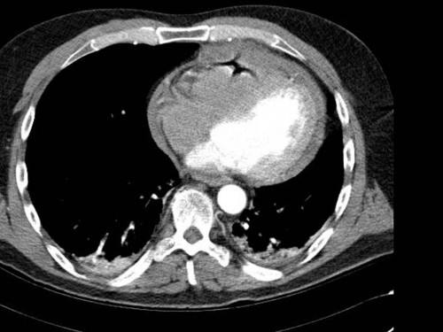 Bildgebung - CT