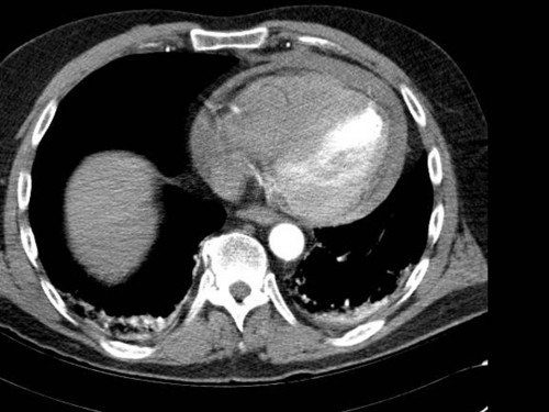 Bildgebung - CT
